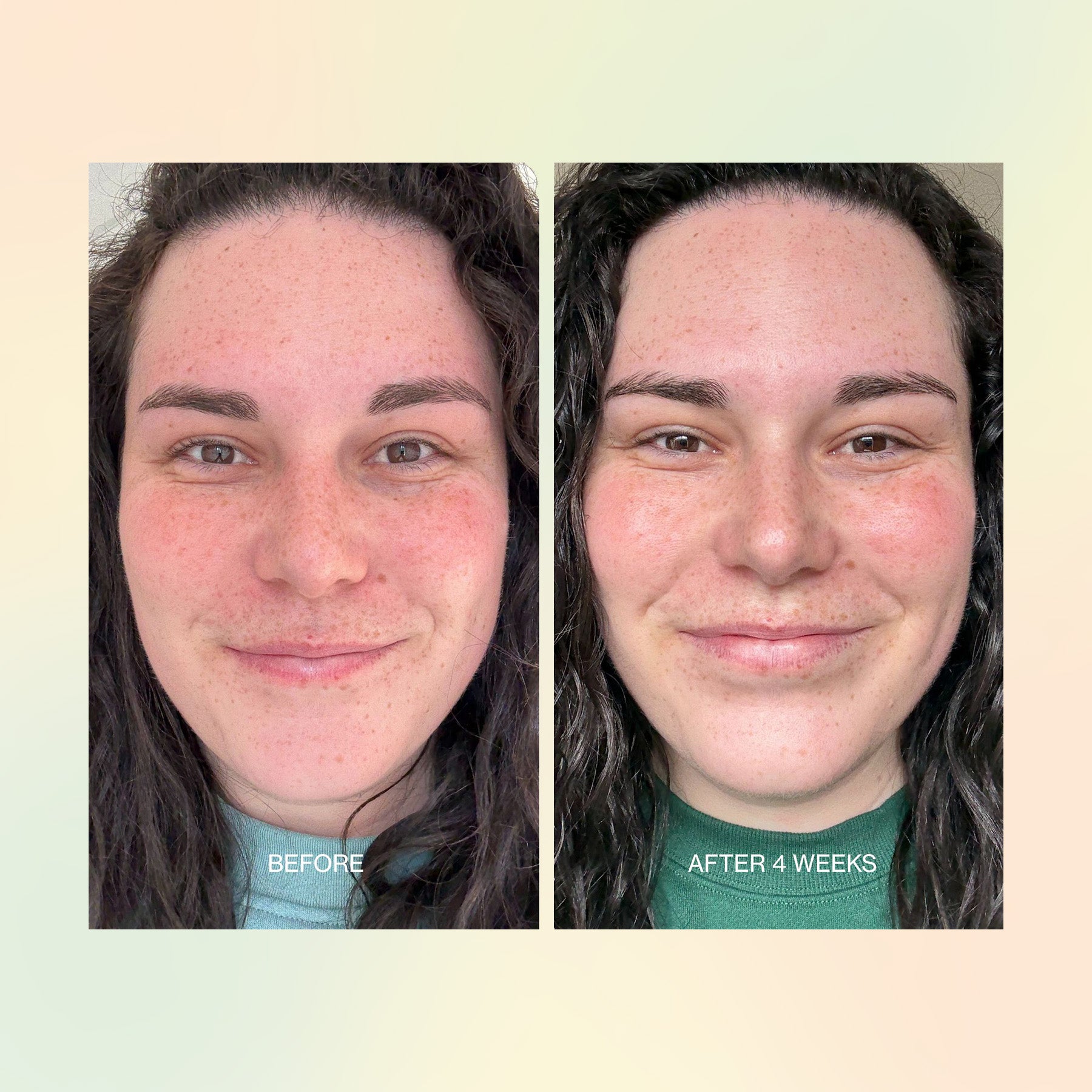 Jojoba Boost Skin Barrier Support